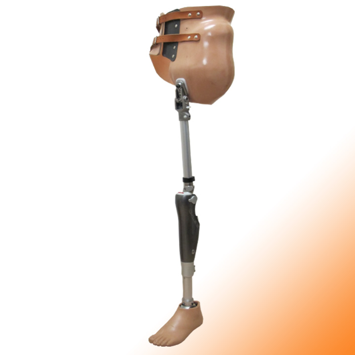 Protézisek, művégtagok, végtagpótlások